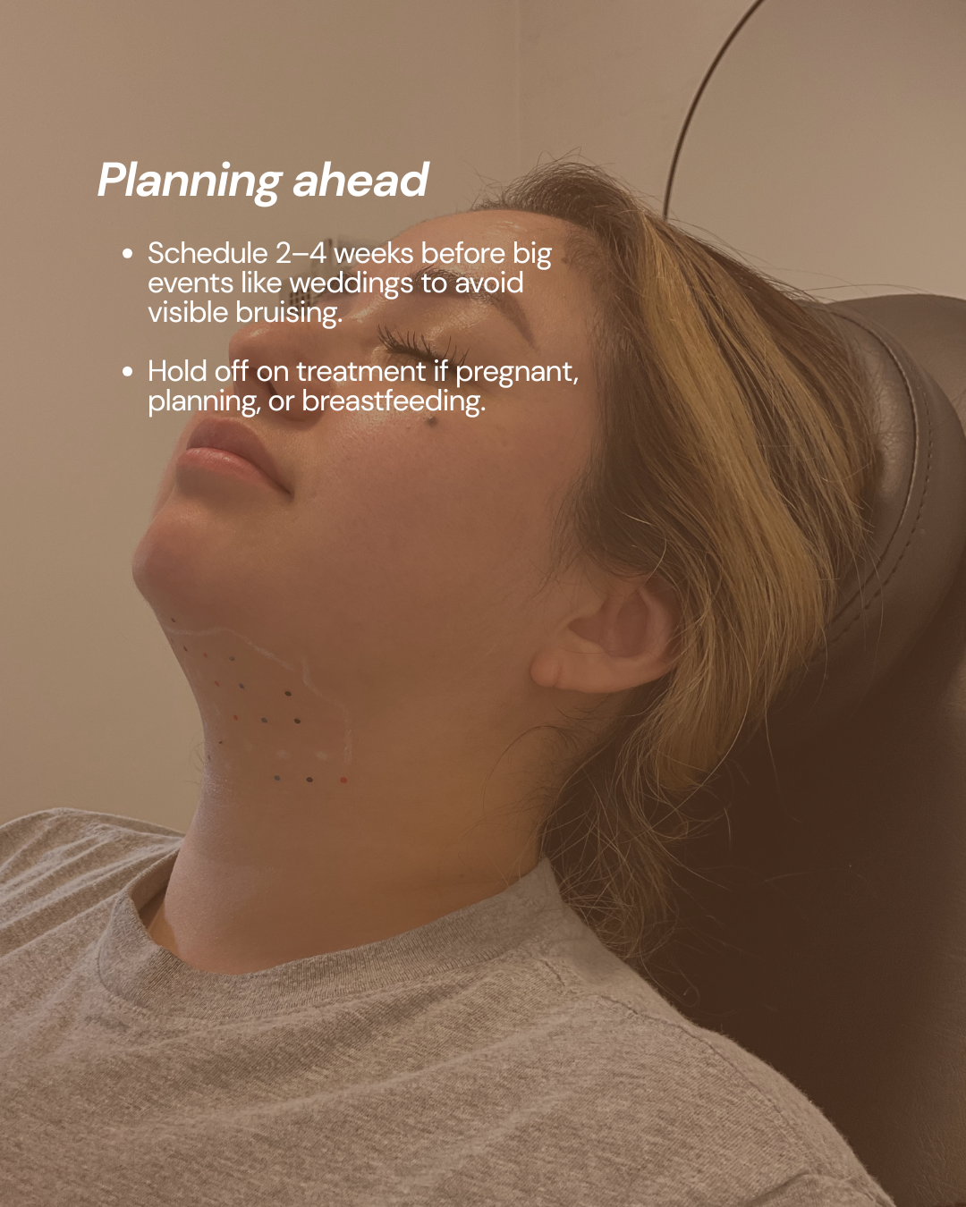 LYEV KYBELLA education graphic: planning ahead, with a client reclined and treatment area marked